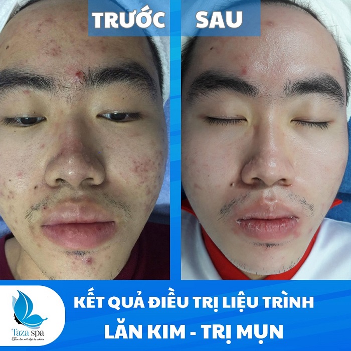 Vien Tham My Taza Spa Nha Trang