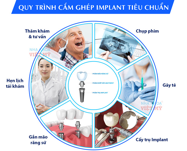 Quy trình trồng răng implant tại Đà Nẵng của Việt Mỹ được diễ ra trong môi trường khép kín và đảm bảo đầy đủ các bước theo tiêu chuẩn.